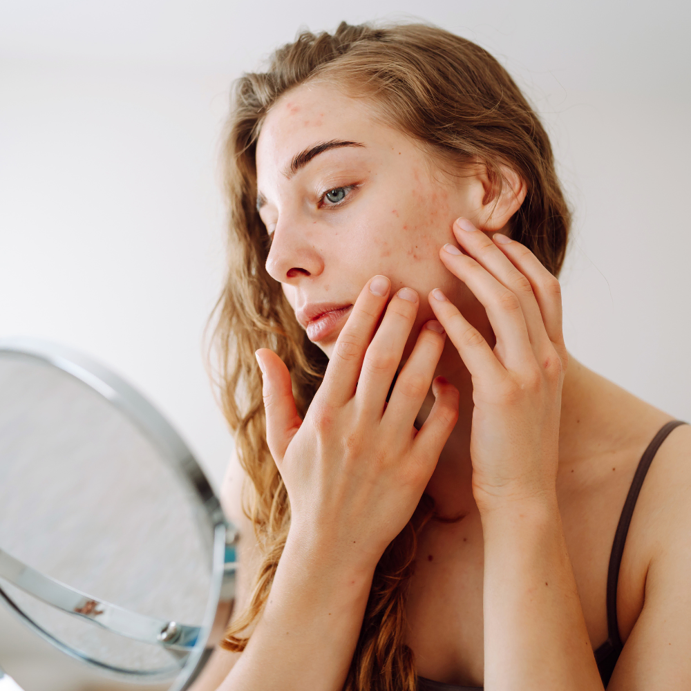 Breakouts and Congestion